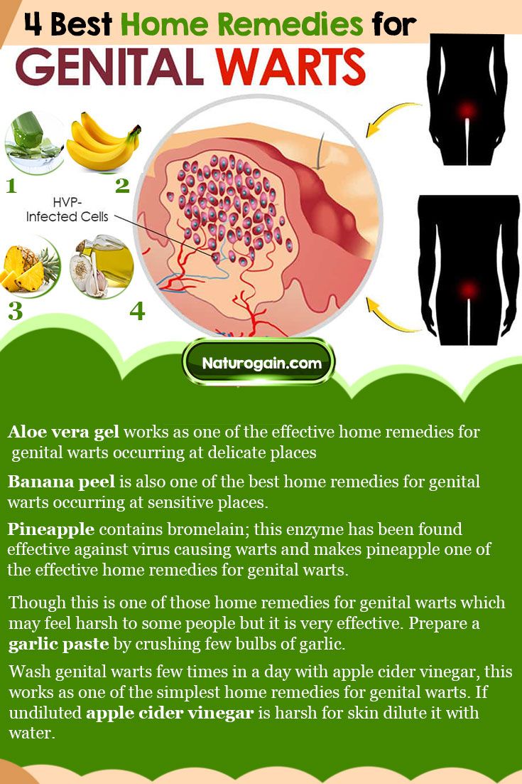 8 Best Home Remedies for Genital Warts that Work