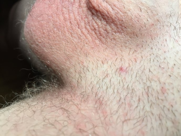 Help! No clue what these small &  big bumps are